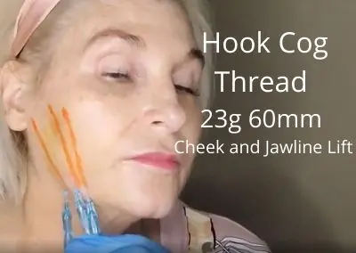 Hook Cog Thread | 23g 60mm | Cheek and Jawline Lift