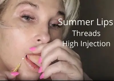 Summer Lips | Threads | High Injection