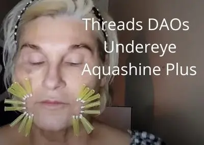 Aquashine Plus | Threads DAOs | Undereye