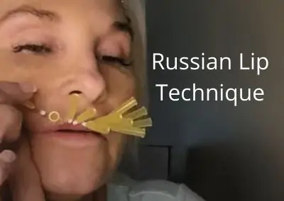 Russian Lip Technique PDO Mesh Pattern