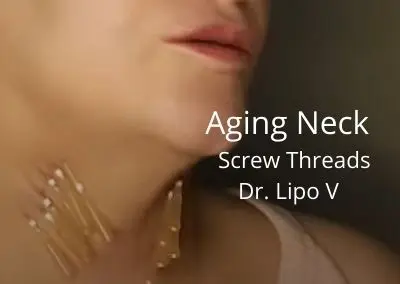 Aging Neck | Dr. Lipo V – Fat Dissolver and Screw Threads | Acecosm.com