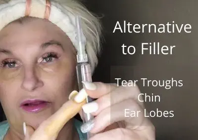 Alternative to Filler | Tear Troughs, Chin, and Rejuvenation of Ear Lobes | Safe and Easy