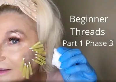 Beginner Threads – Part 1 phase 3 | Total Cheek Restoration | No need for filler !