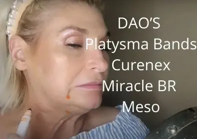 DAO’S | Platysma Bands | Curenex | Miracle BR | Meso