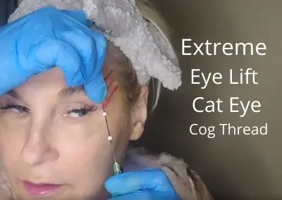 Extreme Eye Lift | Cat Eye | Cog Thread