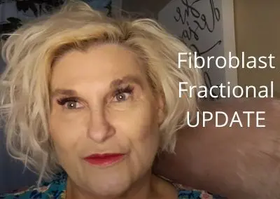 Fibroblast & Fractional Update | Unsettled Threads | Let’s Get Ready for Fall