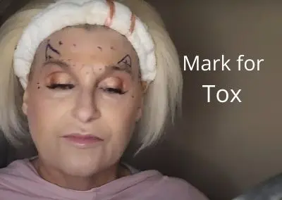 How I mark for Tox | Easy to understand | 11s, Crows Feet, Brow Lift