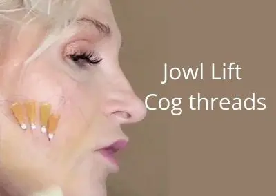 Jowl Lift | Cog threads