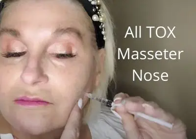 Masseter Slim Face | Tox for the Nose | Fresher Younger Look | All  TOX