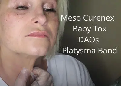 Meso Curenex | Baby tox  |DAOs | Platysma Band