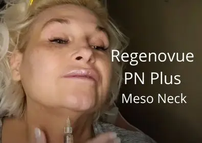 Regenovue PN Plus | Meso Neck and Jawline