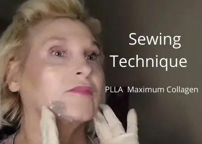 Sewing Technique |  PLLA – Maximum Collagen Threads | First to DIY