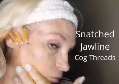 Snatched Jawline |  Cog Threads | Aging Face