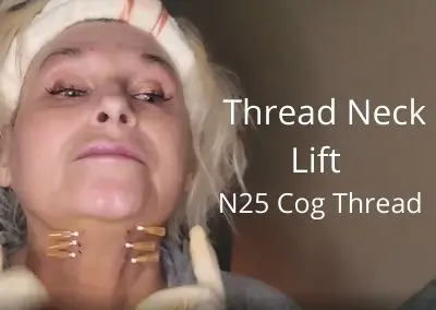 Thread Neck Lift | N25 Cog Thread | My Favorite Cog Thread