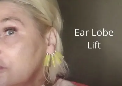 Unreal Ear Lobe Lift  |Non Filler Alternative