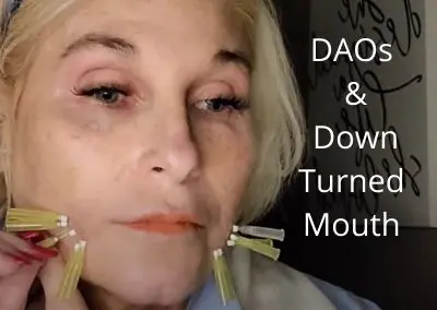 DAOs and Down Turned Mouth