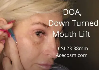 Quick DOA and Down Turned Mouth Lift | CSL23 38mm | Acecosm.com