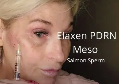 Elaxen PDRN Meso | Salmon Sperm | Acecosm.com DIY55