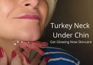 Turkey Neck – Under Chin | Get Glowing Now Skincare