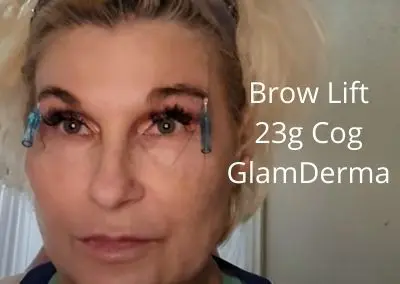 23g Cog Threads from Glamderma