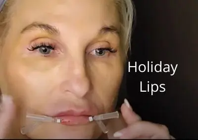 Holiday Lips – Russian Technique with Aquashine Plus and PDO Threads