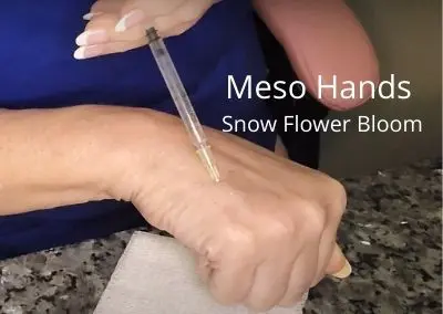 Meso Hands with Snow Flower Bloom from GlamDerma