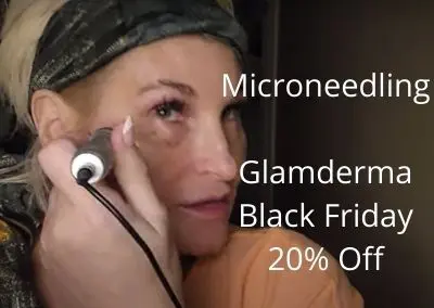 Microneedling – Glamderma Black Friday 20% Off