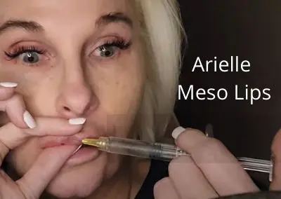 Arielle Meso Lips