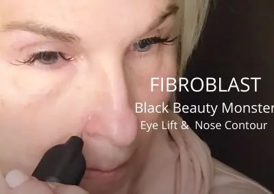 Eye Lift and Nose Contour – Fibroblast with Black Beauty Monster