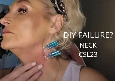 DIY Neck failure!  Let’s do some PDO Cogs