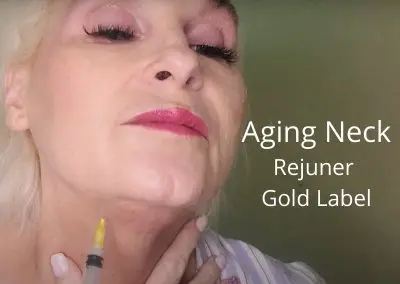 Aging neck – Rejuner Gold Label