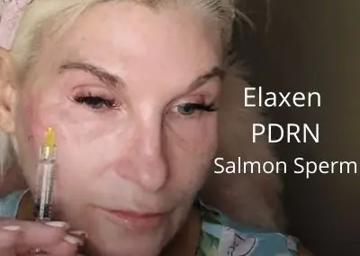 Elaxen PDRN – Salmon Sperm