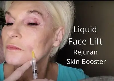 Liquid Face Lift – Rejuran Skin Booster