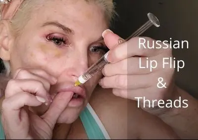 Russia Lip Flip and Thread Day