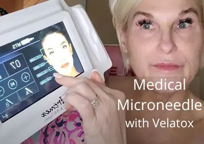 Medical Microneedle with Velatox