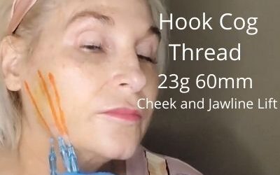 Hook Cog Thread | 23g 60mm | Cheek and Jawline Lift