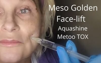 Meso Golden Face-lift | Aquashine | Metoo TOX