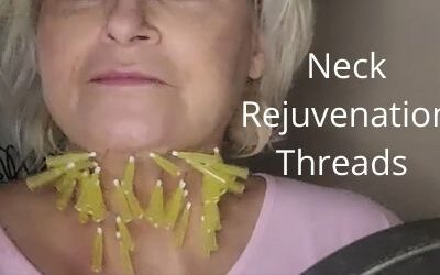 Neck Rejuvenation | Threads | Compare Maypharm Metoo Threads with other Threads