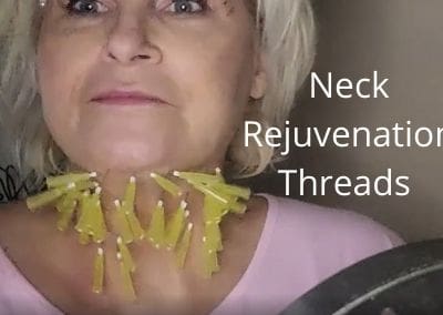 Neck Rejuvenation | Threads | Compare Maypharm Metoo Threads with other Threads