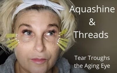 Aquashine and Threads for Tear Troughs the Aging Eye
