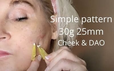 Simple pattern 30g 25mm for Cheek Volume and DAOs