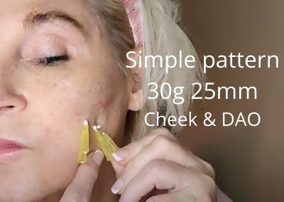 Simple pattern 30g 25mm for Cheek Volume and DAOs