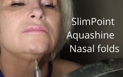 SlimPoint Fat Dissolver | Aquashine | Nasal folds