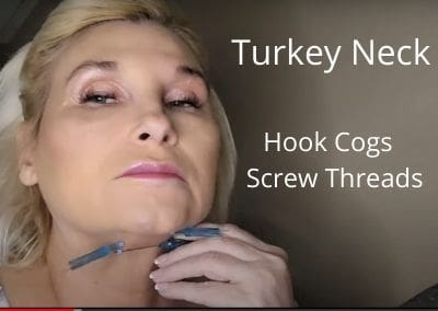 Turkey Neck | Hook Cogs | Screw Threads