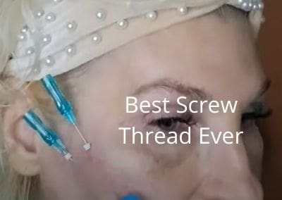 Best Screw Thread Ever 23g 60mm and 23g 60mm Cog Thread | Get Glowing Now Skincare