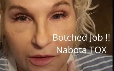 Botched Job !!  Nabota TOX