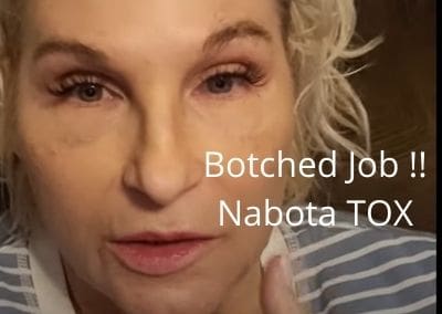 Botched Job !!  Nabota TOX