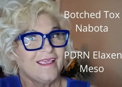 Botched Tox Nabota | PDRN Elaxen Meso