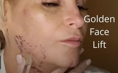Golden Face  Lift | PDRN Elaxen | Nabota TOX