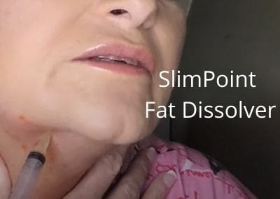 SlimPoint Fat Dissolver